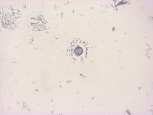 D fragilis 2